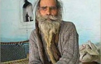 Самым вонючим человеком мира признан 65-летний индус