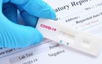 Во Франции начнут продавать тесты на коронавирус
