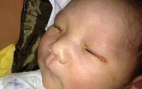 Младенец ослеп из-за смартфона