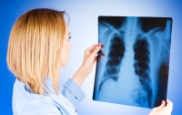 Польша опасается эпидемии туберкулеза со стороны Украины