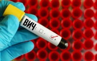 Ученые обнаружили вирус, который помогает бороться с ВИЧ