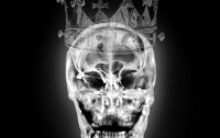 Рентгеновские снимки черепа Ричарда III превратили в арт-объект