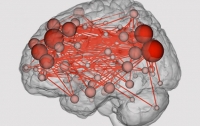 Физики приблизились к созданию искусственного аналога головного мозга