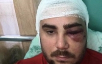 Активного евробляхера сильно побили и подстрелили