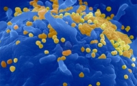 Ученные «вскрыли» код вируса иммунодефицита человека