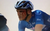 Украинский велосипедист разбил лицо сопернику во время гонки