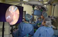 KairoScope-E - первый в мире хирургический эндоскоп, обеспечивающий разрешающую способность в 8К