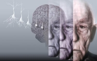 Названы факторы преждевременного старения мозга