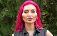 Украинская блогерша с аномально круглыми щеками показала фото до пластики лица