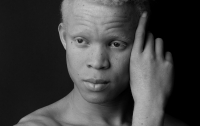19-летний альбинос, сбежавший от колдунов, стал моделью
