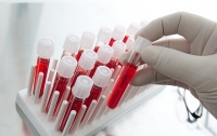 Ученые назвали самую опасную группу крови‍