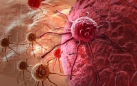 Учёные узнали, какова причина роста раковых опухолей