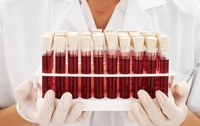 Ученые определили «любимую» группу крови раковых заболеваний
