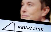 Компания Neuralink впервые имплантировала чип в мозг человека