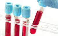 Ученые выяснили, людям с какой группой крови стоит больше опасаться вируса