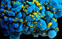 Немецким учёным удалось победить ВИЧ