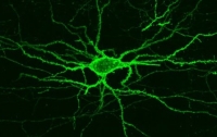 Новая технология позволяет увидеть электрическую деятельность тканей головного мозга