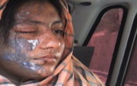 В Пакистане террористы плеснули кислотой в лицо молодой актрисы