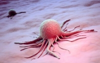 Учёные узнали, что раковые опухоли заразны