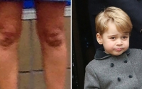 На коленях 40-летней женщины разглядели лицо принца Джорджа