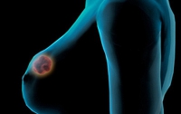 От рака груди лечит смертельный вирус, - ученые