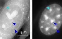 Новый тип микроскопа позволил рассмотреть хромосомную 