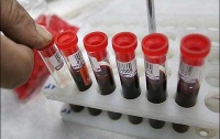 В США появился уникальный тест на ВИЧ