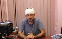 В Одесской области железными битами избили главного редактора местной газеты