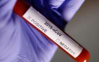 В Черновцах с подозрением на коронавирус госпитализировали четырех человек