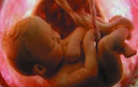 Впервые в мире ребенку успешно сделали операцию до его рождения