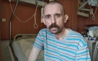В госпитале Киева скончался раненый на Донбассе военный