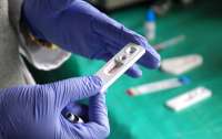 Итальянец получил положительные тесты одновременно на ВИЧ, COVID-19 и оспу обезьян