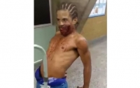 Раненный в голову бразилец гулял по больнице, изображая зомби