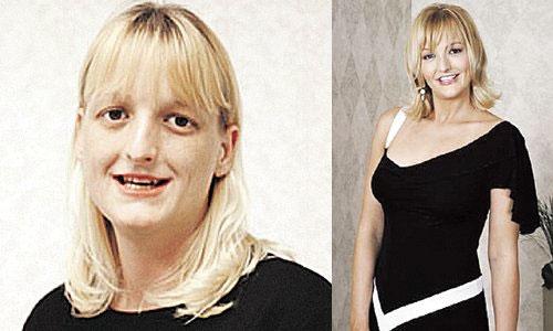 Шедевр, пластическая, хирургия, ФОТО Шедевр, пластическая, хирургия, ФОТО