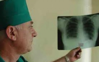Количество погибших от туберкулеза в Украине резко уменьшилось
